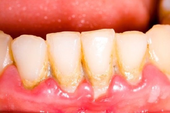 Bạn đã bao giờ tự hỏi mình đã vệ sinh răng miệng đúng cách chưa?
